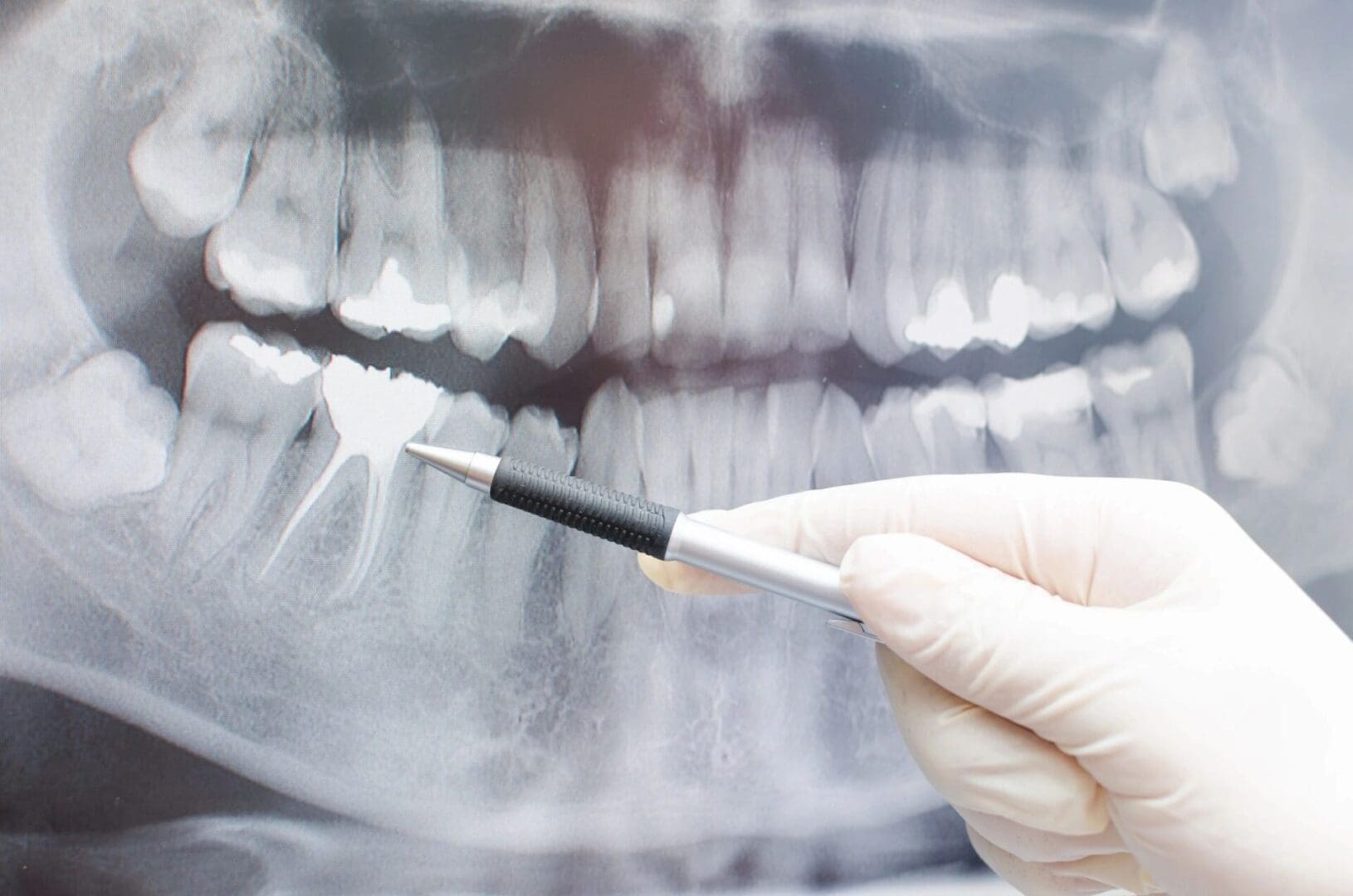 A person holding a tooth brush in front of an x-ray.